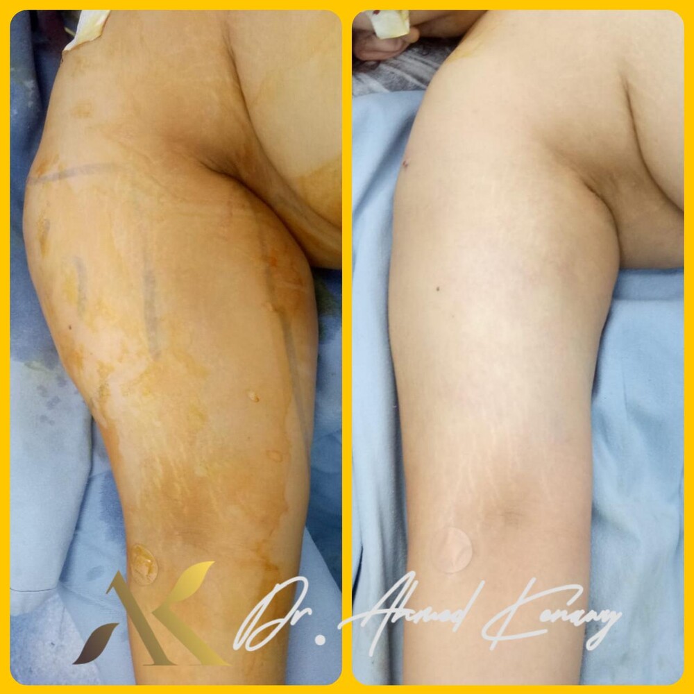 Clinic Results Gallery